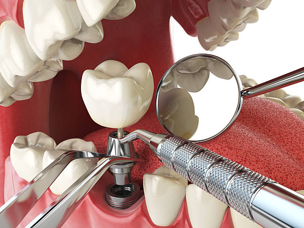 Best Emergency Cosmetic Dentistry (e.g., broken veneers) in Mount Gilead, OH